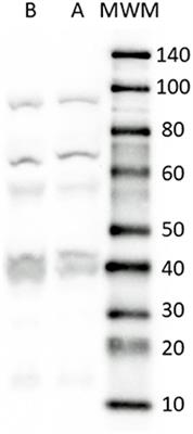 Localization of the Serotonin Transporter in the Dog Intestine and Comparison to the Rat and Human Intestines